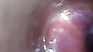 Endoscope POV Test Tube Cock Urethral Insertion