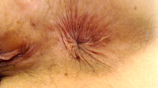 Extreme Asshole Hd Puckers
